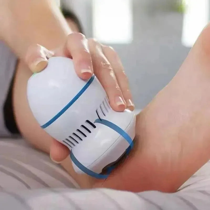 SoleSleek™ Pro Foot Grinder